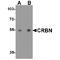 Cereblon antibody, TA349147, Origene, Western Blot image 