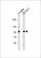 Serine/Threonine Kinase 31 antibody, 62-755, ProSci, Western Blot image 