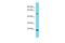 Solute Carrier Family 35 Member F4 antibody, A18613, Boster Biological Technology, Western Blot image 