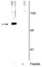 Synapsin I antibody, P03794-2, Boster Biological Technology, Western Blot image 