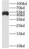 Serine/Threonine Kinase 26 antibody, FNab05385, FineTest, Western Blot image 