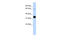 sTnT antibody, 25-740, ProSci, Enzyme Linked Immunosorbent Assay image 