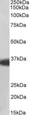 Carnitine O-Octanoyltransferase antibody, 43-306, ProSci, Immunohistochemistry paraffin image 