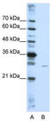 EMG1 N1-Specific Pseudouridine Methyltransferase antibody, TA345952, Origene, Western Blot image 