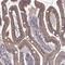 Solute Carrier Family 22 Member 18 antibody, NBP2-57503, Novus Biologicals, Immunohistochemistry frozen image 