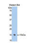 Nuclear Receptor Subfamily 3 Group C Member 1 antibody, LS-C299569, Lifespan Biosciences, Western Blot image 