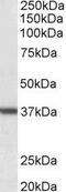 Arginase 1 antibody, GTX89098, GeneTex, Western Blot image 