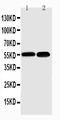 Nuclear Factor Kappa B Subunit 2 antibody, PA1946, Boster Biological Technology, Western Blot image 