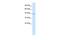 IKAROS Family Zinc Finger 2 antibody, PA5-40417, Invitrogen Antibodies, Western Blot image 