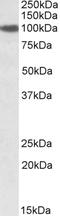 Protein transport protein Sec23A antibody, EB08905, Everest Biotech, Western Blot image 