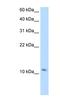 Small muscular protein antibody, NBP1-53165, Novus Biologicals, Western Blot image 