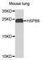 Heat Shock Protein Family B (Small) Member 6 antibody, STJ111929, St John