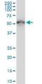 Tubulin Beta 2A Class IIa antibody, H00007280-M04, Novus Biologicals, Western Blot image 