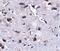 Regulator Of Calcineurin 2 antibody, PA5-20695, Invitrogen Antibodies, Immunohistochemistry paraffin image 