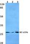 ATP synthase subunit a antibody, A02081, Boster Biological Technology, Western Blot image 