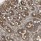 Murine Retrovirus Integration Site 1 Homolog antibody, HPA008704, Atlas Antibodies, Immunohistochemistry paraffin image 