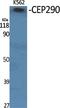 Centrosomal Protein 290 antibody, A01894-1, Boster Biological Technology, Western Blot image 