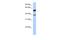 Speckle Type BTB/POZ Protein Like antibody, A14169, Boster Biological Technology, Western Blot image 
