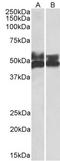 Cysteine protease ATG4A antibody, TA348951, Origene, Western Blot image 