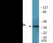 Eukaryotic Translation Initiation Factor 2 Subunit Alpha antibody, EKC2394, Boster Biological Technology, Western Blot image 