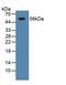 Cytochrome P450 Family 21 Subfamily A Member 2 antibody, LS-C723962, Lifespan Biosciences, Western Blot image 