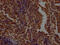 O-Linked N-Acetylglucosamine (GlcNAc) Transferase antibody, CSB-RA232619A0HU, Cusabio, Immunohistochemistry paraffin image 