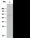 Protein Tyrosine Phosphatase Non-Receptor Type 1 antibody, GTX02121, GeneTex, Immunoprecipitation image 