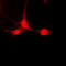 Signal Transducer And Activator Of Transcription 5A antibody, LS-C352887, Lifespan Biosciences, Immunofluorescence image 