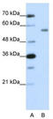 Zinc Finger Protein 497 antibody, TA345631, Origene, Western Blot image 