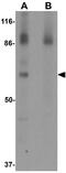 Epithelial Splicing Regulatory Protein 1 antibody, GTX31825, GeneTex, Western Blot image 