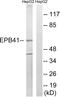 Erythrocyte Membrane Protein Band 4.1 antibody, PA5-39787, Invitrogen Antibodies, Western Blot image 