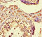 Zinc Finger Protein 408 antibody, LS-C680093, Lifespan Biosciences, Immunohistochemistry paraffin image 