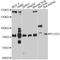 Procollagen-Lysine,2-Oxoglutarate 5-Dioxygenase 3 antibody, abx126376, Abbexa, Western Blot image 