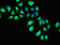 Interleukin 1 Receptor Type 1 antibody, orb52687, Biorbyt, Immunocytochemistry image 
