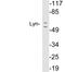 LYN Proto-Oncogene, Src Family Tyrosine Kinase antibody, LS-C199918, Lifespan Biosciences, Western Blot image 