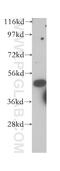 Transcription Factor AP-2 Gamma antibody, 14572-1-AP, Proteintech Group, Western Blot image 