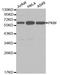 Pyruvate Kinase M1/2 antibody, A0268, ABclonal Technology, Western Blot image 