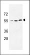 Uridine-Cytidine Kinase 1 Like 1 antibody, 62-717, ProSci, Western Blot image 