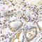 Proteasome Activator Subunit 2 antibody, A5562, ABclonal Technology, Immunohistochemistry paraffin image 