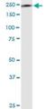 Myosin Heavy Chain 9 antibody, H00004627-M03, Novus Biologicals, Western Blot image 