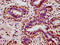Homeobox A11 antibody, LS-C680617, Lifespan Biosciences, Immunohistochemistry paraffin image 