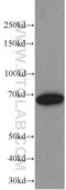 Transketolase antibody, 66016-1-Ig, Proteintech Group, Western Blot image 