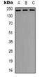 Nuclear Mitotic Apparatus Protein 1 antibody, orb319024, Biorbyt, Western Blot image 