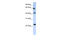 Tetraspanin 3 antibody, 26-151, ProSci, Enzyme Linked Immunosorbent Assay image 