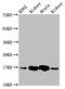 Hemoglobin Subunit Gamma 2 antibody, CSB-PA010156LA01HU, Cusabio, Western Blot image 