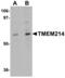 Transmembrane protein 214 antibody, A13159, Boster Biological Technology, Western Blot image 