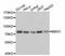 Menin 1 antibody, A2264, ABclonal Technology, Western Blot image 