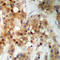 Casein Kinase 2 Alpha 1 antibody, LS-C358961, Lifespan Biosciences, Immunohistochemistry frozen image 
