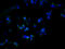 Zinc Finger DHHC-Type Containing 23 antibody, A61866-100, Epigentek, Immunofluorescence image 
