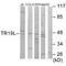 RELT TNF Receptor antibody, A10639, Boster Biological Technology, Western Blot image 